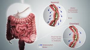 Understanding Diarrhea: Symptoms, Diagnosis, Treatment, Prevention, Effective Management Guidelines by WHO 2024